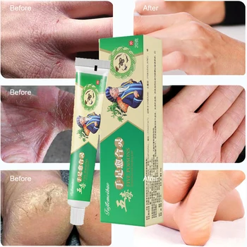 Травяной крем для ног против трещин Drynes Foot Mask Крем для восстановления трещин на пятках, Увлажняющий Крем для рук, удаление мозолей, омертвевшей кожи, Уход за руками и ногами